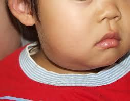 くび 顔の病気について おぎわら耳鼻咽喉科クリニック