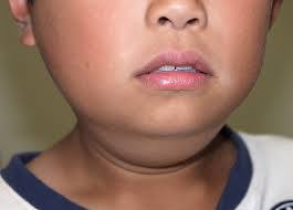 くび 顔の病気について おぎわら耳鼻咽喉科クリニック